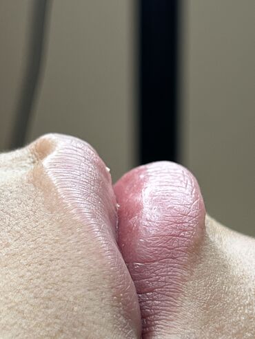 Косметология: Косметология, Ботокс, Биоревитализация, Ботулинотерапия, Консультация, Гипоаллергенные материалы, Сертифицированный косметолог — 28