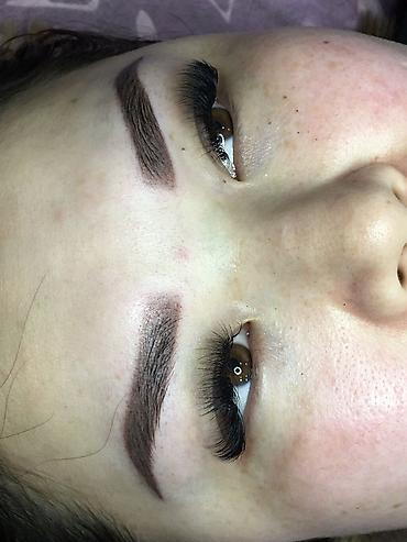 Косметология: Косметология, Ботокс, Биоревитализация, Ботулинотерапия, С выездом на дом, Консультация, Гипоаллергенные материалы — 26