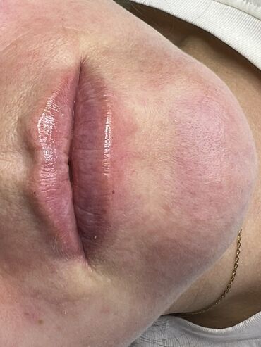 Косметика: Процедура перманентного макияжа губ позволяет придать губам желаемый — 24