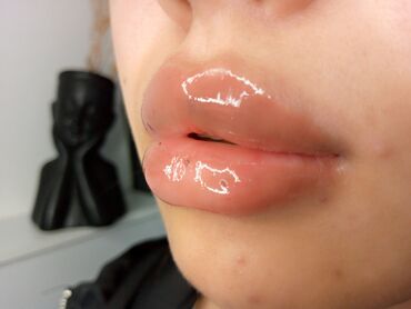 Косметология: Косметология, Биоревитализация, Ботулинотерапия, Контурное моделирование, Гипоаллергенные материалы, Консультация, Сертифицированный косметолог — 15