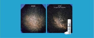 Saçlara qulluq: Saç maskası, Hər növ saçlar üçün, Yeni, Ünvandan götürmə, Pulsuz çatdırılma, Ödənişli çatdırılma — 14