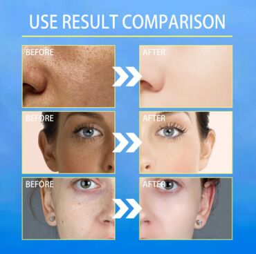 Уход за телом: ❄️ сша крем интенсивный отбеливающий антивозрастной ▶ быстрое — 2