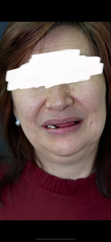 художественная реставрация зубов композитными материалами: Адрес: Бишкек, проспект Жибек-Жолу, 215 Чистка 3х этапная 1500 сом