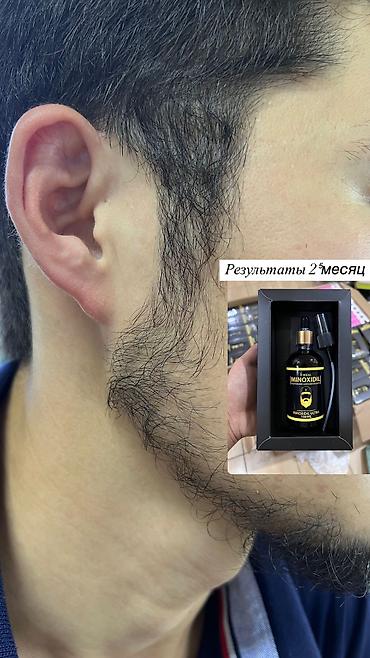 Уход за телом: Рост борода и волосы Миноксидил ультра 15% оригинал✅из Турции🇹🇷 — 14