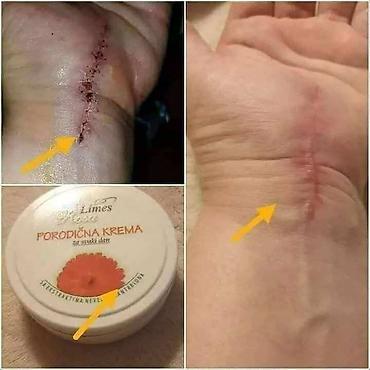 Nega kože: Limes Rosa Porodična krema – kantarion i neven Višenamenska krema za — 13