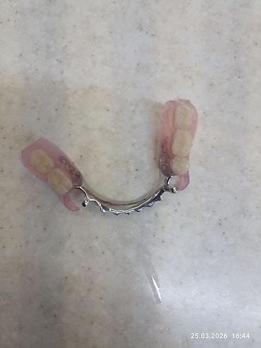 Ортезы: Съемные частичные зубные протезы - Тип: частичные протезы для верхней — 14