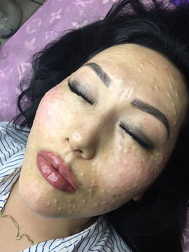 Косметология: Косметология, Ботокс, Биоревитализация, Ботулинотерапия, С выездом на дом, Консультация, Гипоаллергенные материалы — 14