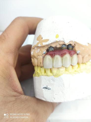 Sağlamlıq və gözəllik: Diş texnikliyi kursları(6 ay erzinde tam öyredilir, stomotoloji — 3