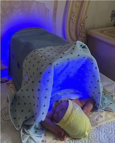 Медицинские лампы: Фотолампа от желтушки желтуха билирубин Фотолампа от желтухи, или — 3