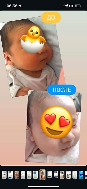синий лампа: Аренда/Продажа/ Эффект через сутки✅ Фотолампа для лечения желтухи у — 2