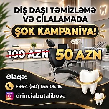 gümüş diş: Xidmət: Diş daşı təmizləmə və cilalama ünvan: Əhmədli metro stansiyası — 1