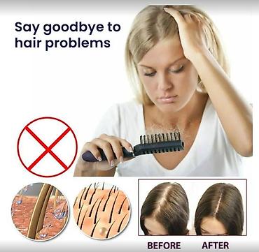 Уход за телом: США против выпадения волос ouhoe от облысения восстанавливающий спрей — 6