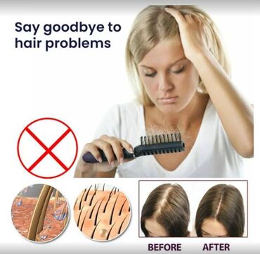 Уход за телом: США Спрей от выпадения волос влюсомс волосы для волос цена- 400 — 8