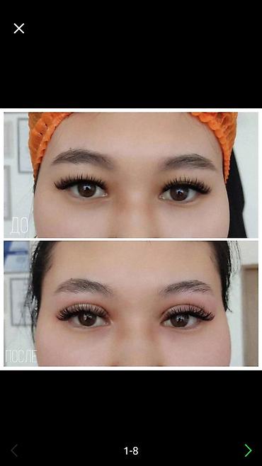 Косметология: Косметология, Брыли, Ботокс, Биоревитализация, Консультация, Гипоаллергенные материалы, Сертифицированный косметолог — 7