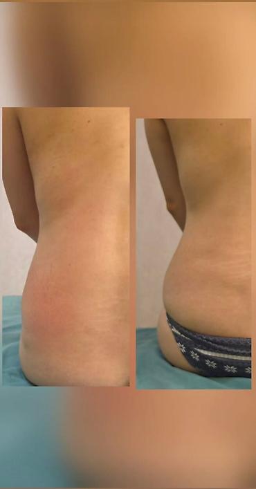 massage: Klassik masaj, Kişilər üçün, Qadınlar üçün, Evə gəlməklə — 2