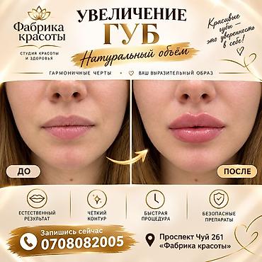 Контурная пластика губ гиалуроновым филлером. - Цель: увеличение at lalafo.kg Контурная пластика губ гиалуроновым филлером. - Цель: увеличение