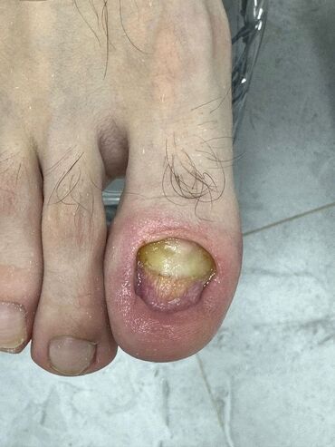 Маникюр, педикюр: Наращивание ногтей, Гель лак, шеллак, Укрепление ногтей, Услуги подолога, Маникюр, Педикюр, Консультация, Одноразовые расходные материалы — 6