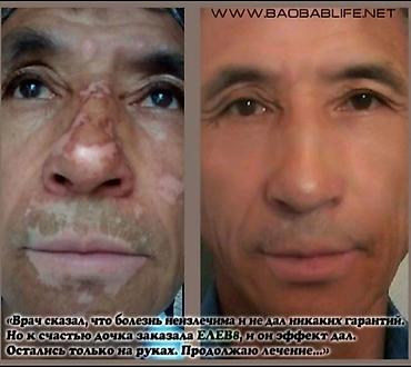 Витамины и БАДы: Елев8 Elev8 Элеф8 Элев8 Елеф8 БАД в стиках и капсулах Бишкек — 11