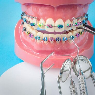 брекеты цена джалал абад: Стоматолог | Брекет системы, пластинки | Консультация