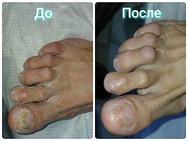 Маникюр: Дизайн, Донаращивание ногтей, Наращивание ногтей, Маникюр, Педикюр, Требуются модели, С выездом на дом, Одноразовые расходные материалы — 10