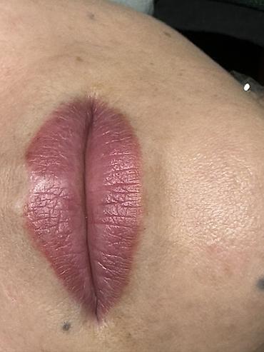 Косметология: Косметология, Увеличение губ, Гипоаллергенные материалы at lalafo.kg — 30 Косметология: Косметология, Увеличение губ, Гипоаллергенные материалы — 30