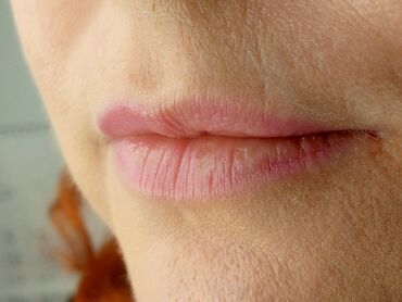 Косметология: Косметология, Биоревитализация, Ботулинотерапия, Контурное моделирование, Гипоаллергенные материалы, Консультация, Сертифицированный косметолог — 24