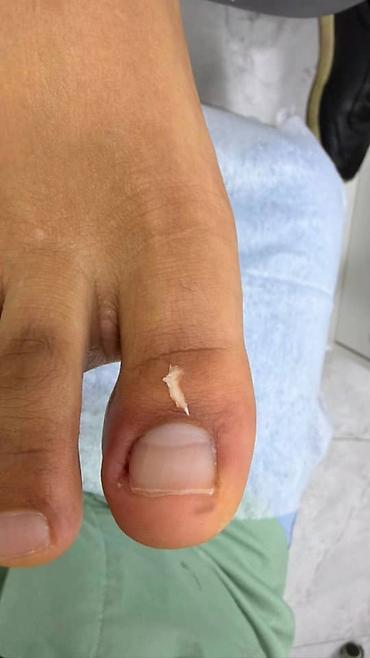 Маникюр: Коррекция вросших ногтей, Услуги подолога, Маникюр, Педикюр, Услуга в 4 руки, Одноразовые расходные материалы, Консультация — 6