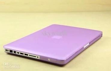 usta cantasi: Macbook Pro 15 digonal model ucun qoruyucu keys. Ust/alt ve — 2