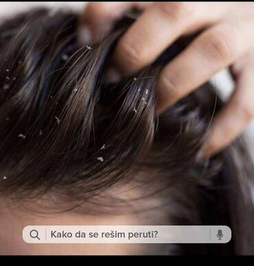 Nega kose: 🌸 Recite ZBOGOM peruti! 🌸 Isprobali ste sve, ali perut i dalje tu? 😕 — 2