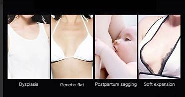 Товары для взрослых: США Вырасти сама себе грудь своей мечты ! листайте фото Эфирное масло — 7