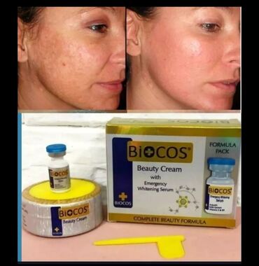 Biocos krem+serum Bu problemleri kokunden.hell.edin sonradan emele
