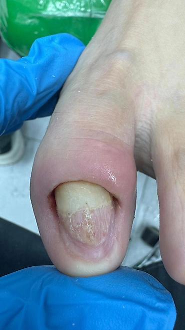 Маникюр: Коррекция вросших ногтей, Маникюр, Педикюр, Услуги подолога, С выездом на дом, Консультация, Одноразовые расходные материалы — 19