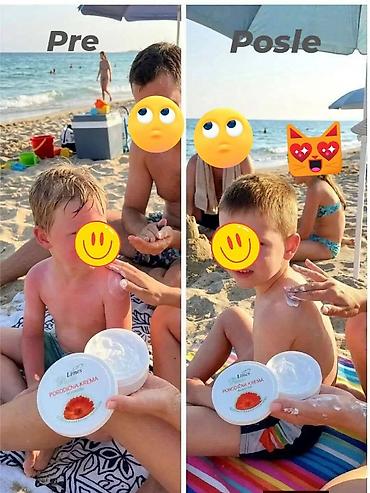 Nega kože: Nemojte ići na plažu bez ove kreme 🤗 🌿 PORODIČNA KREMA – melem koji — 13
