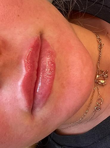 Косметология: Косметология, Ботокс, Биоревитализация, Ботулинотерапия, Консультация, Гипоаллергенные материалы, Сертифицированный косметолог at lalafo.kg — 9 Косметология: Косметология, Ботокс, Биоревитализация, Ботулинотерапия, Консультация, Гипоаллергенные материалы, Сертифицированный косметолог — 9