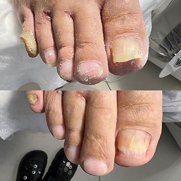 Маникюр: Маникюр • Педикюр • Подология Профессиональный уход за руками и — 4