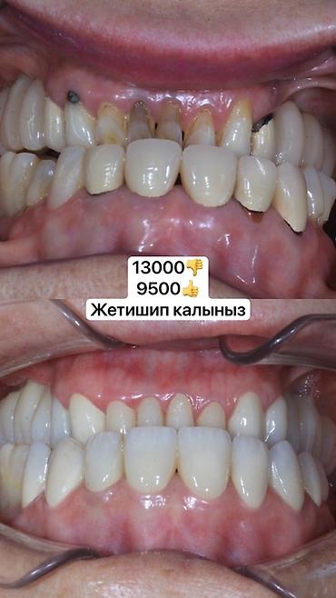 Красота и здоровье: Стоматологические услуги: реставрация и протезирование зубов - Полная — 1