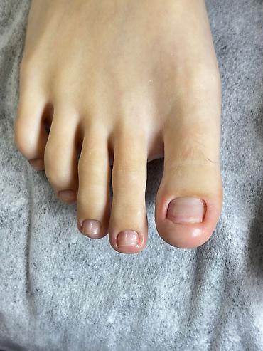 Маникюр, педикюр: Коррекция вросших ногтей, Услуги подолога, С выездом на дом, Консультация, Одноразовые расходные материалы — 12