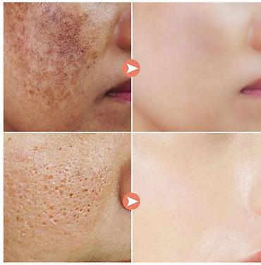 Уход за телом: ❄️ США с Аmazon Walmart и Fruugo Крем консилер и осветлитель для лица — 20