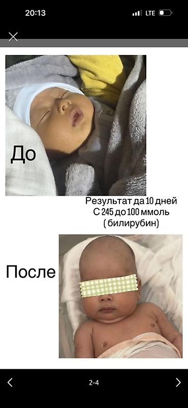 товары для инвалидов: Фототерапевтическая лампа для лечения неонатальной желтухи (домашнего — 4