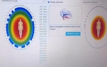 Техника и электроника: Биорезонансное тестирование WebWellness — комплексная компьютерная — 4