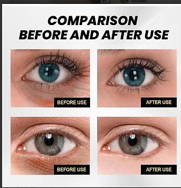 Уход за телом: США Подтяжка без ботокса Скорая помощь от морщин мгновенное — 14