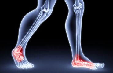 Другая мужская обувь: Стельки ортопедические(специализированные) от плоскостопия! Для — 18