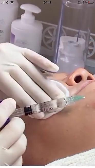 Косметология: Косметология, Ботокс, Биоревитализация, Ботулинотерапия, С выездом на дом, Консультация, Гипоаллергенные материалы — 16