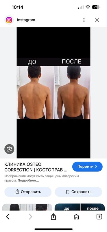 как получить ипотеку без первоначального взноса бишкек: Дарыгерлер | Костоправ | Диагностика