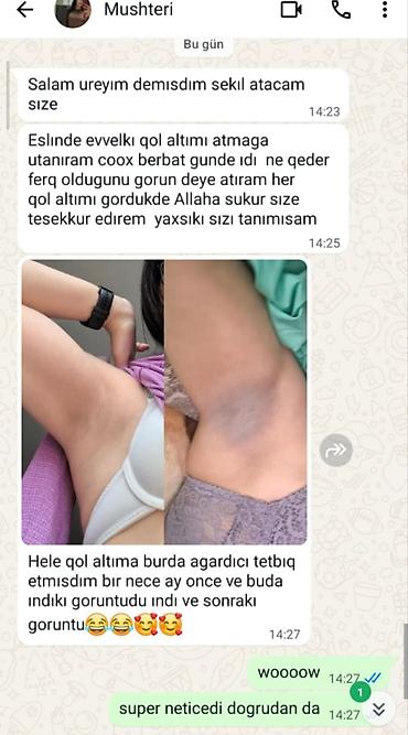 d3 nar qiymeti: Qolaltı qaralma və ləkələr üçün ağardırıcı baxım seti Məhsulun — 4