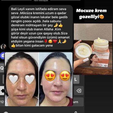 Üz kremləri və serumları: Leke ve cilleri yox eden krem seti 6 mehsul 30 azn