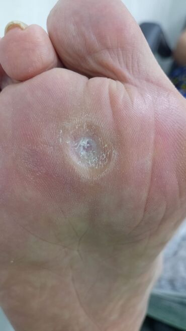 Маникюр, педикюр: Коррекция вросших ногтей, Маникюр, Педикюр, Услуги подолога, Консультация, Одноразовые расходные материалы — 12