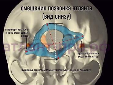 шейный машины: Врачи | Костоправ — 3
