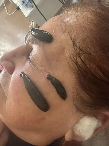 Hicama, zəli: Xidmət: Kupa terapiyası (quru və yaş/hicama), bel–boyun–çiyin masajı — 5