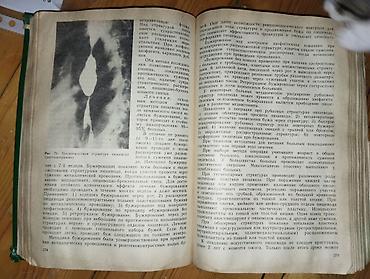 Книги и журналы: Məhsul: “Xirurgik Xəstəliklər” (Хирургические болезни) – tibbi dərslik — 2